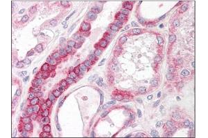 Human Kidney: Formalin-Fixed, Paraffin-Embedded (FFPE) (ST6GAL1 抗体  (Internal Region))