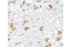 Immunohistochemistry (Paraffin-embedded Sections) (IHC (p)) image for anti-Phosphatidylinositol-5-Phosphate 4-Kinase, Type II, beta (PIP4K2B) antibody (ABIN7264077)