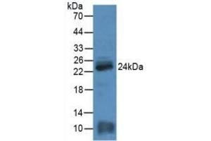 Western Blotting (WB) image for anti-Myosin Light Chain 4, Alkali, Atrial, Embryonic (MYL4) (AA 4-187) antibody (ABIN7439036)