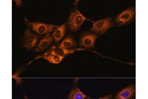 Immunofluorescence analysis of NIH/3T3 cells using C1 Inactivator Polyclonal Antibody at dilution of 1:100.