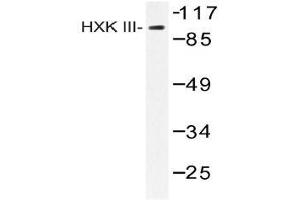 Western blot (WB) analysis of HXK III antibody in extracts from Jurkat insulin 0. (HK3 抗体)