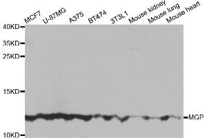 Western blot analysis of extracts of various cell lines, using MGP antibody (ABIN5975376) at 1/1000 dilution. (MGP 抗体)
