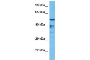Host:  Mouse  Target Name:  GFI1  Sample Tissue:  Mouse Liver  Antibody Dilution:  1ug/ml (GFI1 抗体  (N-Term))