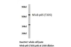 Western blot (WB) analyzes of NFκB-p65 antibody in extracts from raw264. (NF-kB p65 抗体)