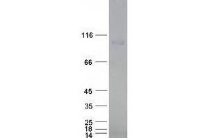 Exportin 2 Protein (Myc-DYKDDDDK Tag)