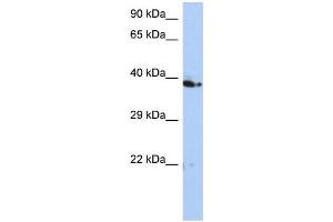 WB Suggested Anti-C10orf46 Antibody Titration: 0. (CACUL1 抗体  (Middle Region))