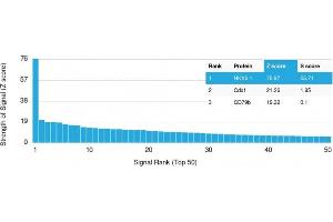 Analysis of Protein Array containing more than 19,000 full-length human proteins using NKX6. (NKX6-1 抗体)