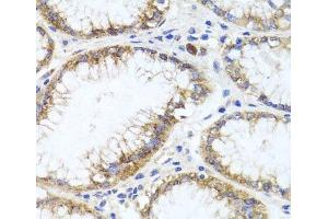 Immunohistochemistry of paraffin-embedded Human stomach using GPM6A Polyclonal Antibody at dilution of 1:100 (40x lens). (GPM6A 抗体)