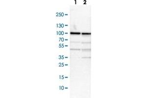Western blot analysis of Lane 1: NIH-3T3 cell lysate (Mouse embryonic fibroblast cells) Lane 2: NBT-II cell lysate (Rat Wistar bladder tumour cells) with RPS6KA3 polyclonal antibody  at 1:100-1:250 dilution.
