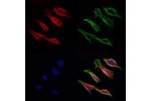 ABIN6257028 and ABIN6275977 staining Hela cells by IF/ICC. (CCZ1B 抗体)
