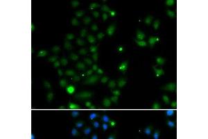 Immunofluorescence analysis of MCF-7 cells using GCM1 Polyclonal Antibody (GCM1 抗体)