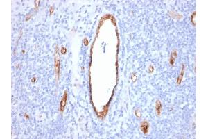 Formalin-fixed, paraffin-embedded human Tonsil stained with vWF Recombinant Mouse Monoclonal Antibody (rVWF/2480). (Recombinant VWF 抗体)