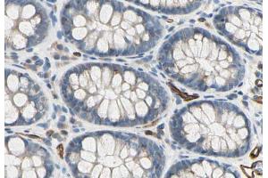 ABIN6278318 at 1/100 staining human colon    sections by IHC-P. (CD93 抗体  (C-Term))