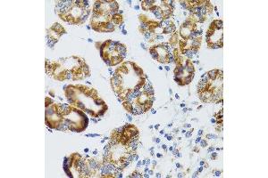 Immunohistochemistry of paraffin-embedded human stomach using RIPK4 antibody. (RIPK4 抗体  (AA 240-520))
