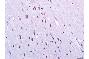 Paraformaldehyde-fixed, paraffin embedded Mouse brain, Antigen retrieval by boiling in sodium citrate buffer (pH6. (gamma 1 Adaptin 抗体  (AA 721-822))