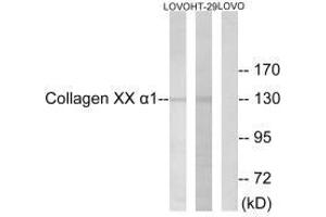 Western blot analysis of extracts from HUVEC cells, using Collagen XX α1 antibody. (COL2A1 抗体  (C-Term))