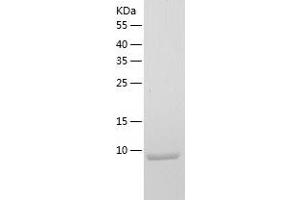 Western Blotting (WB) image for Secretoglobin, Family 2A, Member 2 (SCGB2A2) (AA 19-93) protein (His tag) (ABIN7287086) (Mammaglobin A Protein (AA 19-93) (His tag))