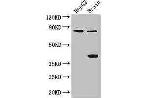 Western Blot Positive WB detected in: HepG2 whole cell lysate, Mouse brain tissue All lanes: FIGN antibody at 3 μg/mL Secondary Goat polyclonal to rabbit IgG at 1/50000 dilution Predicted band size: 83 kDa Observed band size: 83, 38 kDa (Fidgetin 抗体  (AA 132-371))