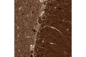 Immunohistochemical staining of human cerebellum with ZNF512 polyclonal antibody  shows strong cytoplasmic and nucleolar positivity in Purkinje cells. (ZNF512 抗体)