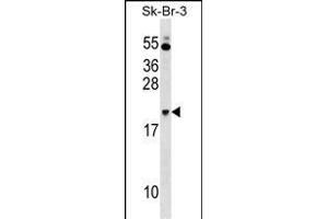 NKIRAS1 Antibody (Center) (ABIN1538446 and ABIN2849067) western blot analysis in SK-BR-3 cell line lysates (35 μg/lane). (NKIRAS1 抗体  (AA 48-76))
