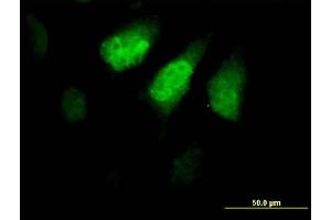 Immunofluorescence of purified MaxPab antibody to ZNF259 on HeLa cell. (ZNF259 抗体  (AA 1-459))