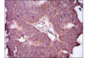 Immunohistochemistry (IHC) image for anti-EGFR Mutant (AA 693-893), (Mutant) antibody (ABIN1845729) (EGFR Mutant (AA 693-893), (Mutant) 抗体)