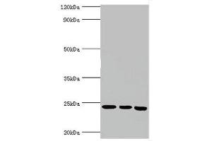 Western blot All lanes: BAG family molecular chaperone regulator 2 antibody at 6 μg/mL Lane 1: Jurkat whole cell lysate Lane 2: Hela whole cell lysate Lane 3: HepG2 whole cell lysate Secondary Goat polyclonal to rabbit IgG at 1/10000 dilution Predicted band size: 24, 21 kDa Observed band size: 24 kDa (BAG2 抗体  (AA 1-211))
