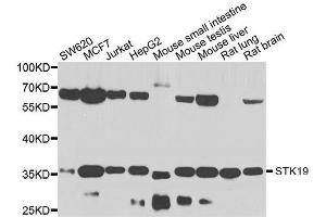 Western blot analysis of extracts of various cell lines, using STK19 antibody. (STK19 抗体  (AA 75-364))