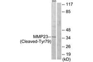Western blot analysis of extracts from 293 cells, treated with etoposide 25uM 1h, using MMP23 (Cleaved-Tyr79) Antibody. (Matrix Metallopeptidase 23 (MMP23) (AA 60-109), (Cleaved-Tyr79) 抗体)