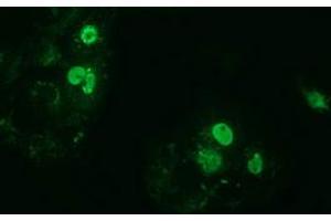 Immunofluorescence (IF) image for anti-Zinc Finger, Imprinted 2 (ZIM2) (AA 1-150), (AA 428-527) antibody (ABIN1490590) (ZIM2 抗体  (AA 1-150, AA 428-527))