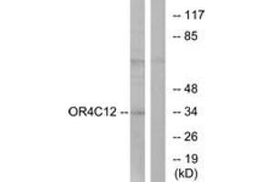 Western blot analysis of extracts from Jurkat cells, using OR4C12 Antibody. (OR4C12 抗体  (AA 260-309))