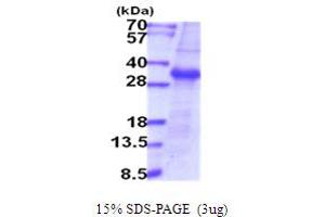 SDS-PAGE (SDS) image for Transmembrane Protease, serine 15 (TMPRSS15) (AA 785-10199) protein (ABIN5854071) (TMPRSS15 Protein (AA 785-10199))