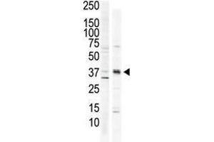 The anti-CAMK1 C-term Pab is used in Western blot to detect CAMK1 in HeLa cell lysate (lane 1) and primate brain tissue lysate (lane 2). (CAMK1 抗体  (C-Term))