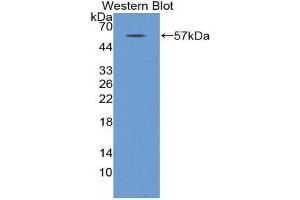 Western Blotting (WB) image for anti-Myosin Heavy Chain 2, Skeletal Muscle, Adult (MYH2) (AA 1238-1472) antibody (ABIN1859925) (MYH2 抗体  (AA 1238-1472))