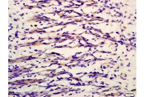 Formalin-fixed and paraffin embedded mouse embryonic muscle labeled with Anti-phospho-MYL9(Thr19) Polyclonal Antibody, Unconjugated (ABIN753238) at 1:200 followed by conjugation to the secondary antibody and DAB staining (MYL9 抗体  (pThr19))