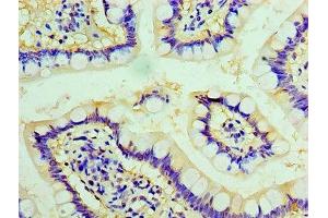 Immunohistochemistry of paraffin-embedded human small intestine tissue using ABIN7147728 at dilution of 1:100 (Chromogranin A 抗体  (AA 19-457))