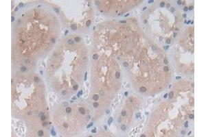 Immunohistochemistry (IHC) image for anti-Proteasome (Prosome, Macropain) Subunit, beta Type, 6 (PSMB6) (AA 2-239) antibody (ABIN7436234)