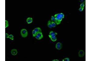 Immunofluorescence staining of MCF-7 cells with ABIN7150062 at 1:133, counter-stained with DAPI. (ADAM8 抗体  (AA 677-824))
