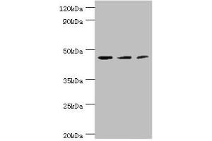 Western blot All lanes: ACY1 antibody at 4 μg/mL Lane 1: K562 whole cell lysate Lane 2: HepG2 whole cell lysate Lane 3: Mouse kidney tissue Secondary Goat polyclonal to rabbit IgG at 1/10000 dilution Predicted band size: 46, 38, 39, 43 kDa Observed band size: 46 kDa (Aminoacylase 1 抗体  (AA 1-408))