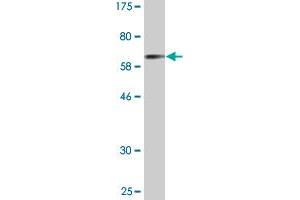 Western Blot detection against Immunogen (67. (Cathepsin E 抗体  (AA 18-396))