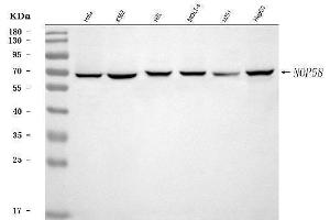 Western blot analysis of NOP58 using anti-NOP58 antibody (ABIN7601224).