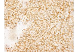 Immunohistochemistry (IHC) image for anti-RpL7a/SURF3 (C-Term) antibody (ABIN7449015) (RpL7a/SURF3 (C-Term) 抗体)