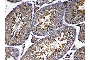 IHC analysis of PARK7 / DJ1 using anti-PARK7 / DJ1 antibody . (PARK7/DJ1 抗体  (AA 2-189))
