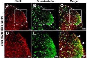 Double immunofluorescence staining revealed the expression of the Slack channel (A,D, in red) in somatostatin positive neurons (B,E, in green).