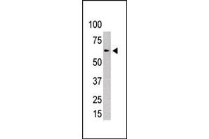 Western blot analysis of PIASx1/2 polyclonal antibody (ABIN6242527 and ABIN6577329) in Y79 cell lysate.