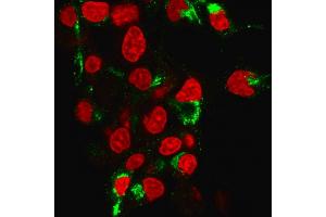 Immunofluorescence Analysis of human HePG2 cells labeling Albumin with Albumin Mouse Monoclonal Antibody (ALB/2355) followed by Goat anti-Mouse IgG-CF488 (Green).