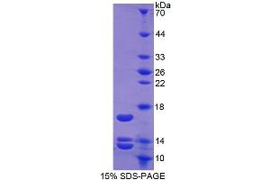 SDS-PAGE analysis of Human Urocortin 2 Protein. (Urocortin 2 Protein (UCN2))