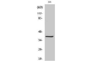 Western Blotting (WB) image for anti-Melanoma Antigen Family C, 2 (MAGEC2) (Internal Region) antibody (ABIN3185441) (MAGEC2 抗体  (Internal Region))