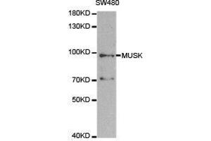 Western Blotting (WB) image for anti-Muscle, Skeletal, Receptor Tyrosine Kinase (MUSK) antibody (ABIN1873783) (MUSK 抗体)