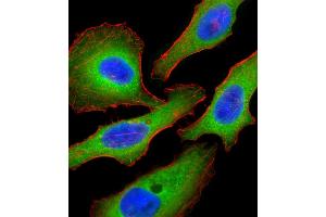 Fluorescent confocal image of Hela cell stained with Tuberin (TSC2) Antibody  (ABIN390324 and ABIN2840755). (Tuberin 抗体  (AA 1776-1805))